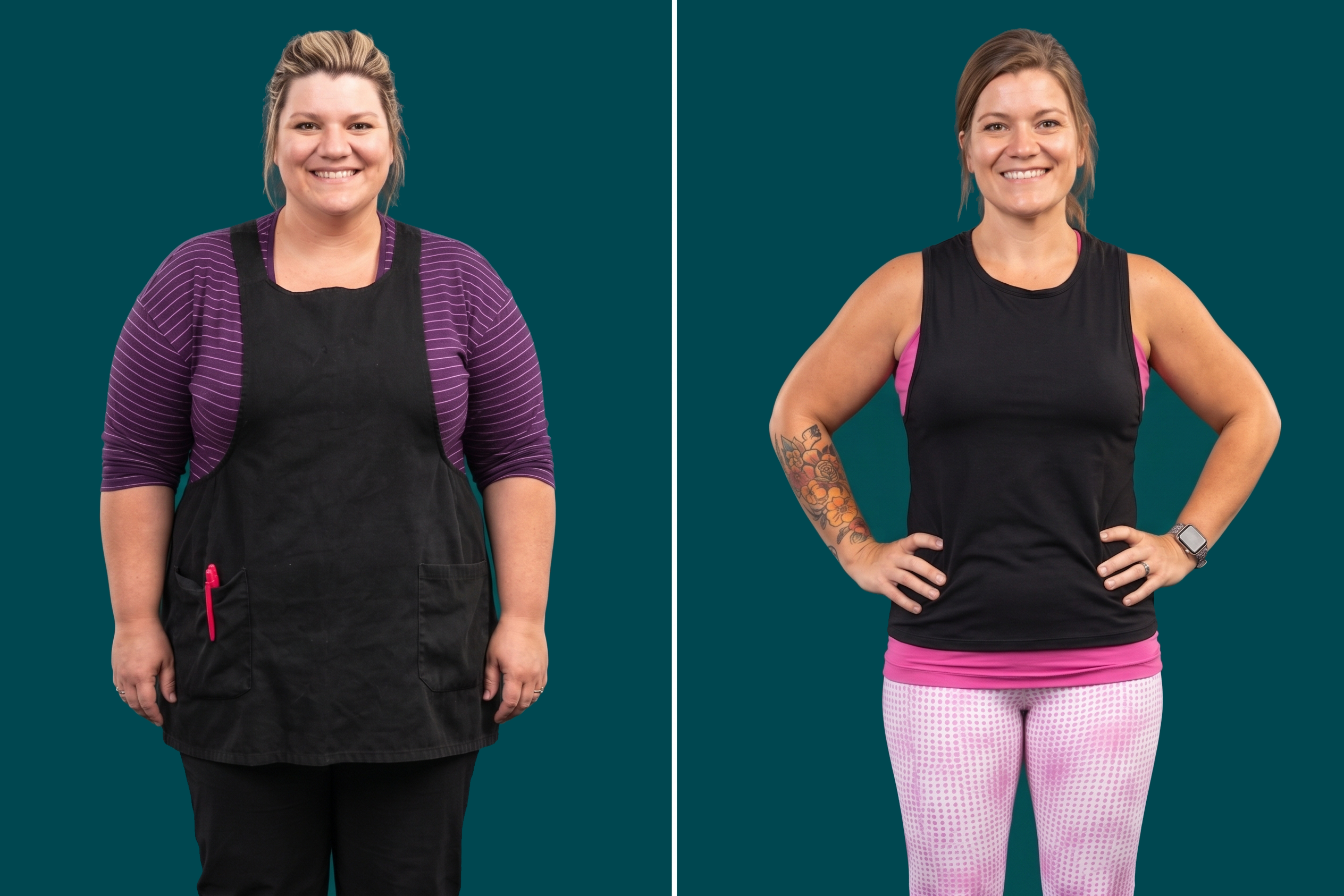 Weight Loss Surgery 10