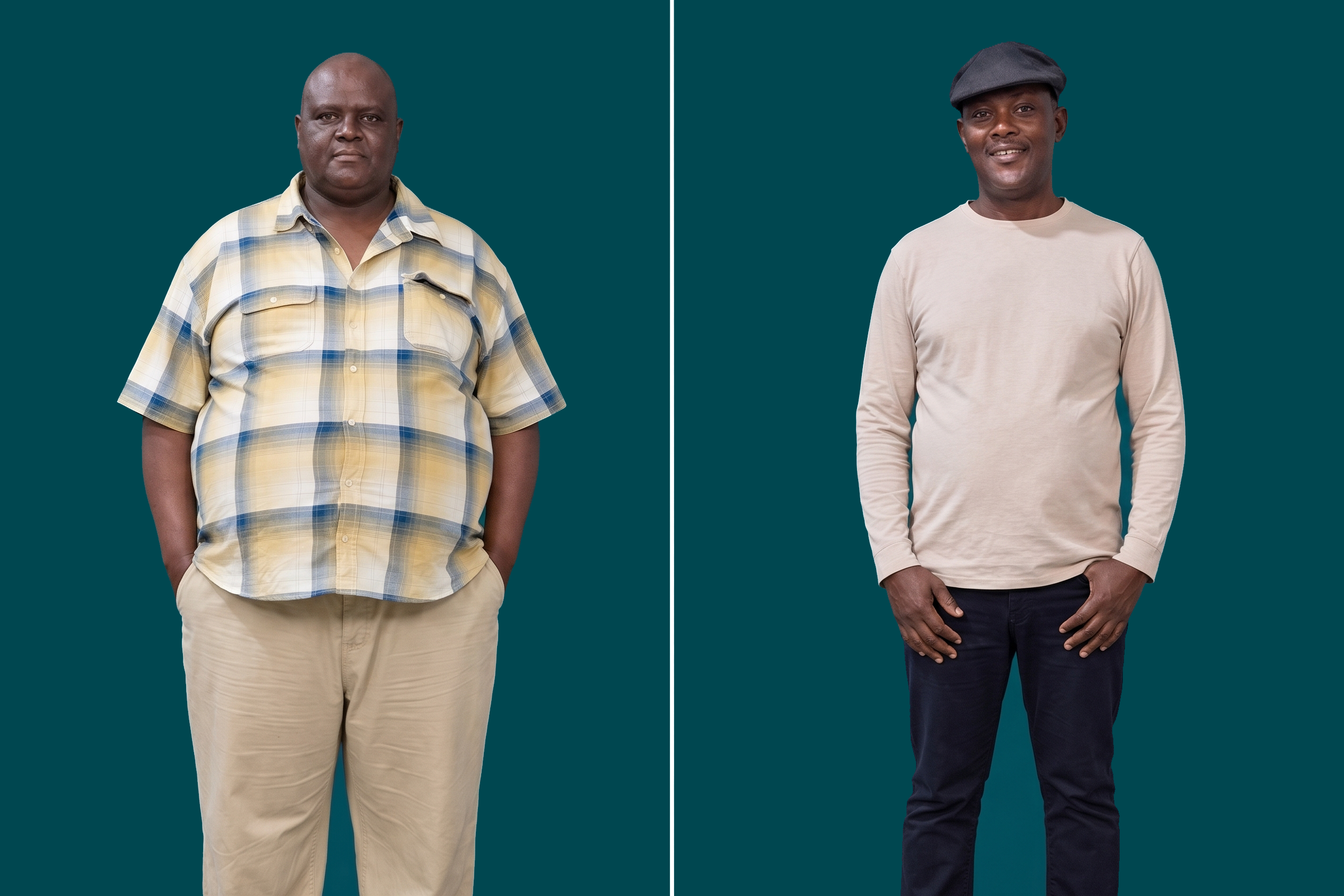 Weight Loss Surgery 11