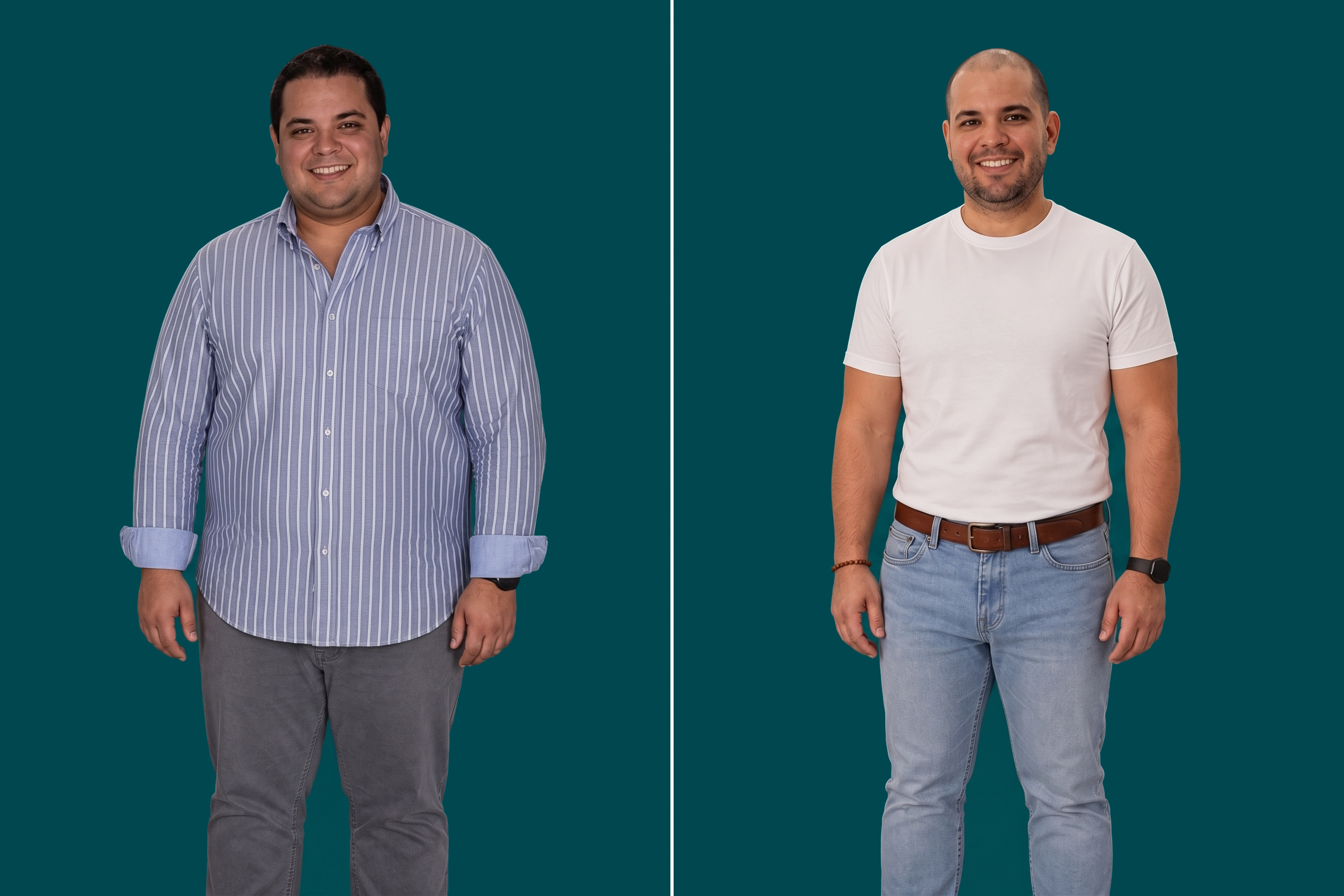 Weight Loss Surgery 13