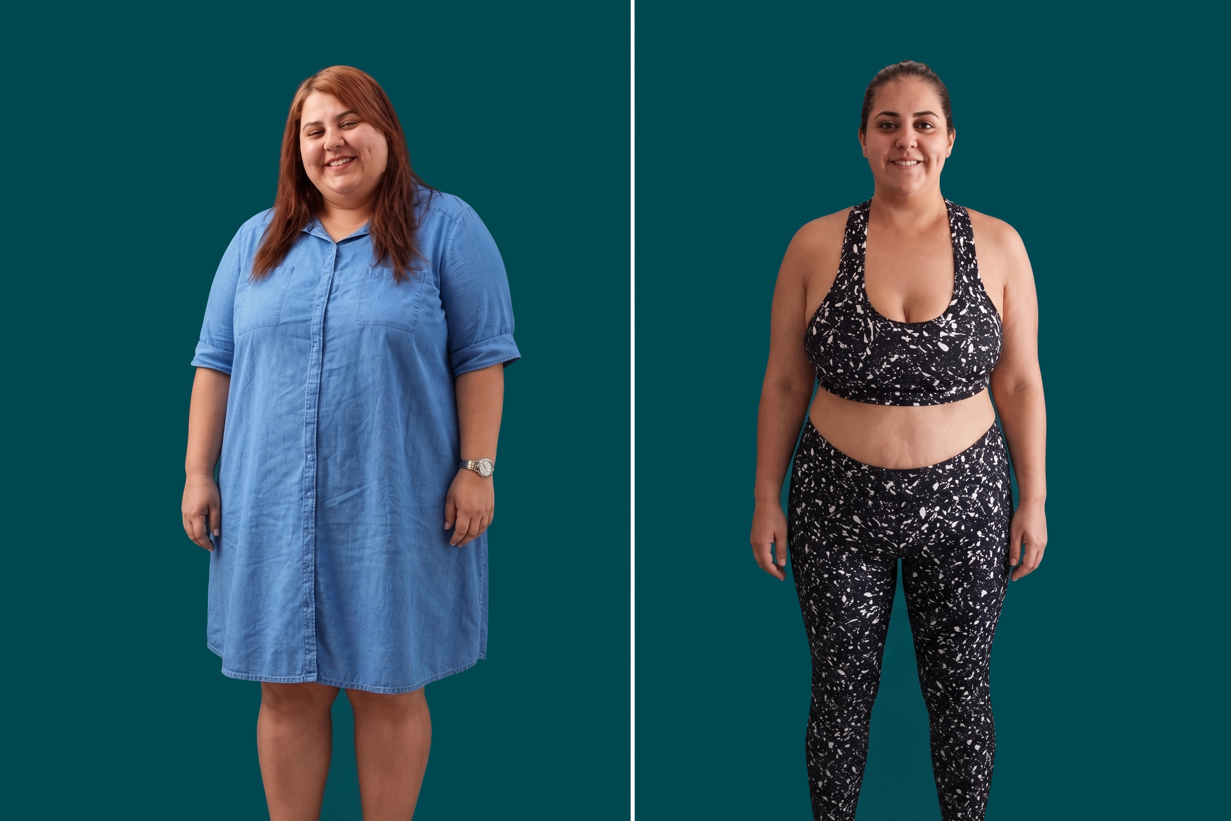 Weight Loss Surgery-Gastric Balloon 1