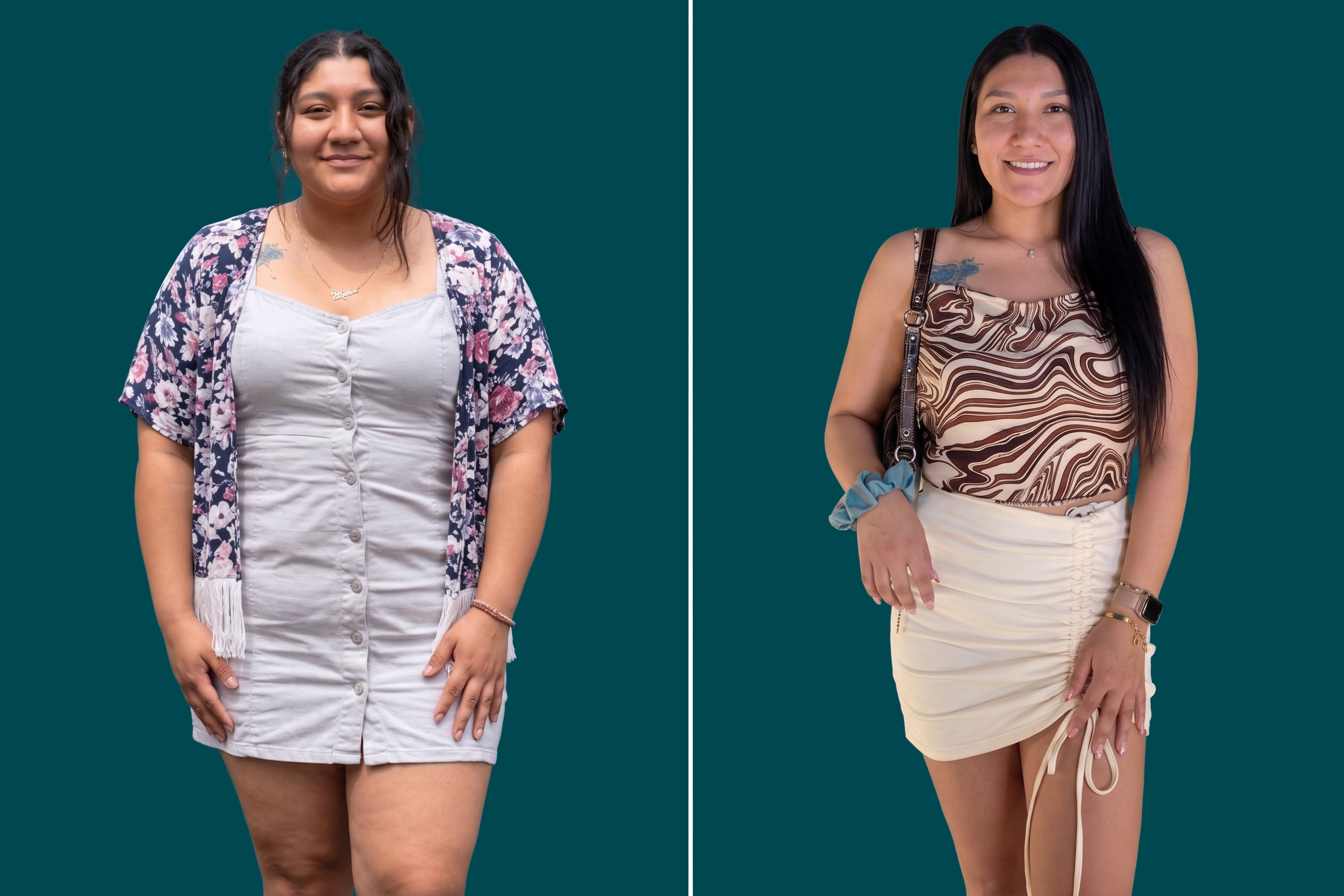 Weight Loss Surgery 7
