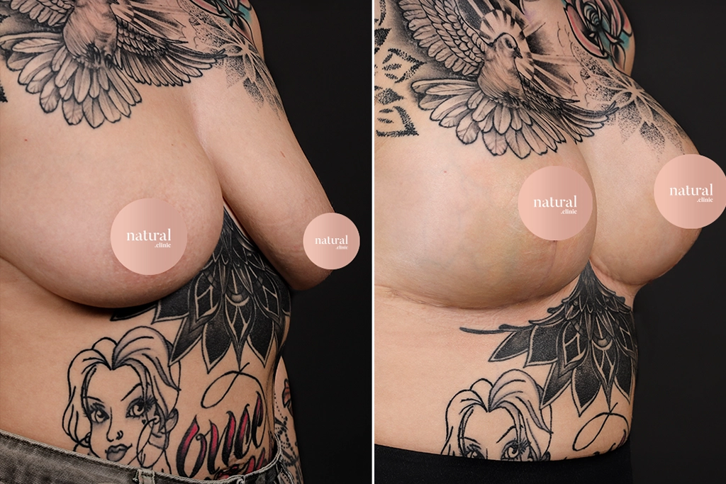 Before treatment