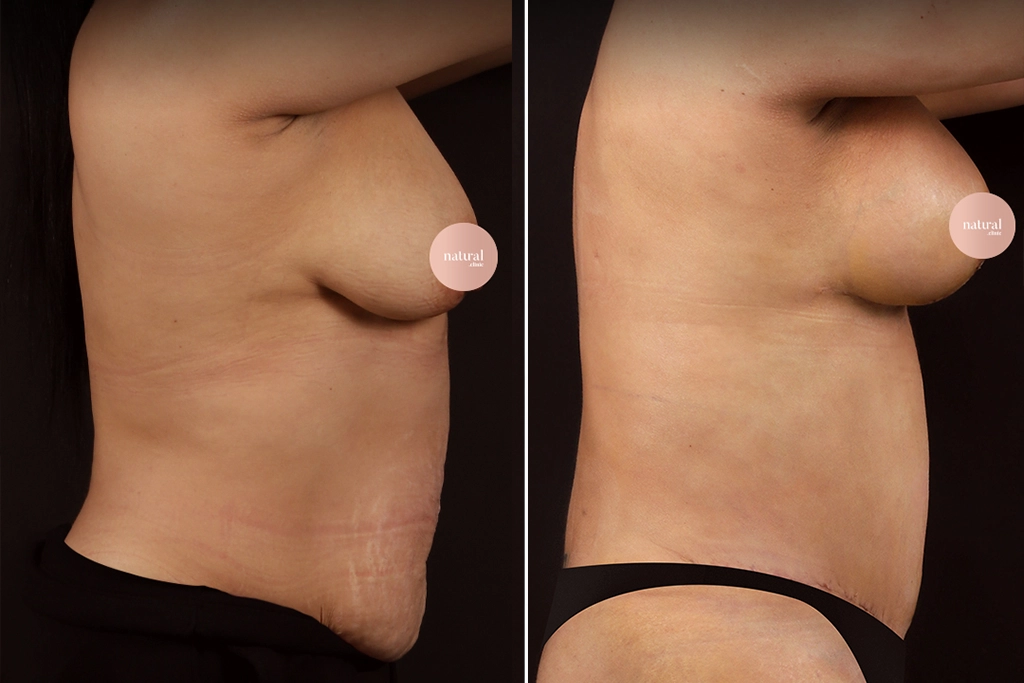 Before treatment