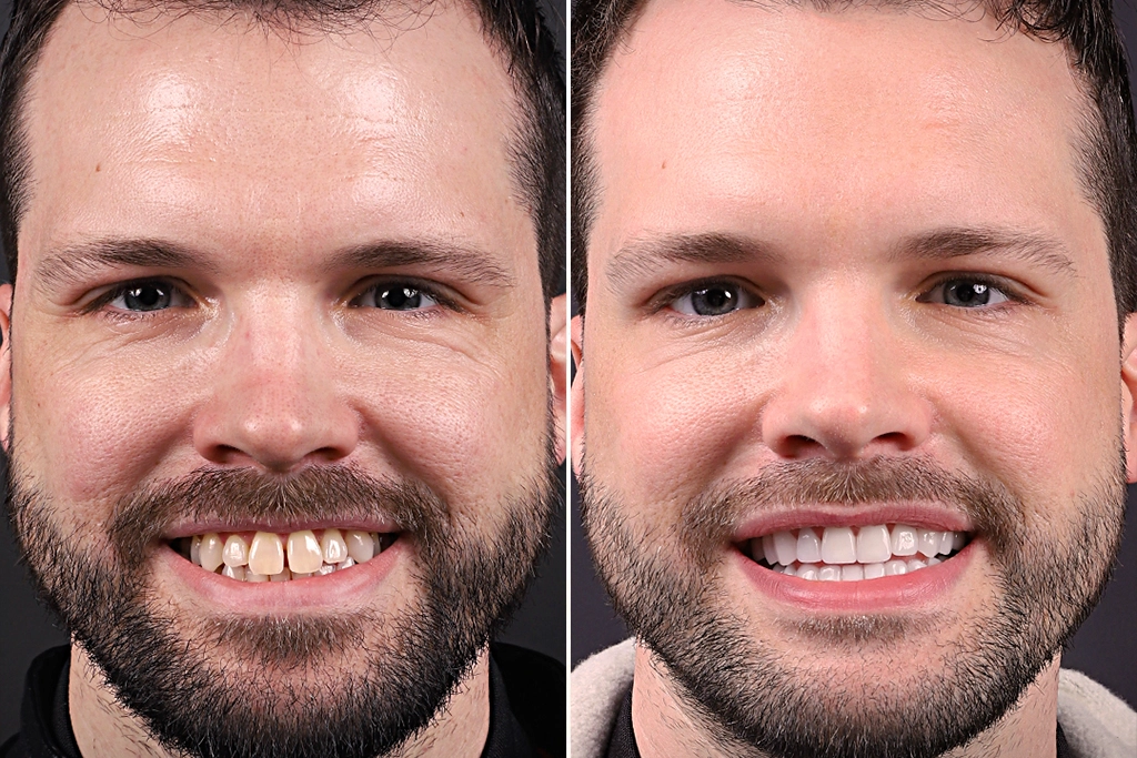 Before treatment