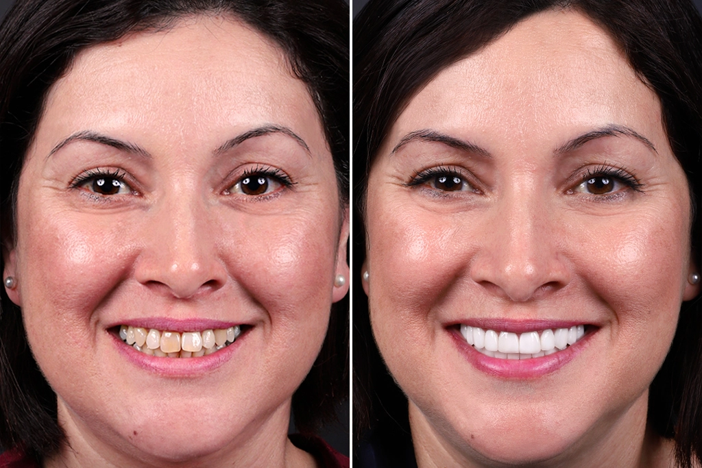 Before treatment