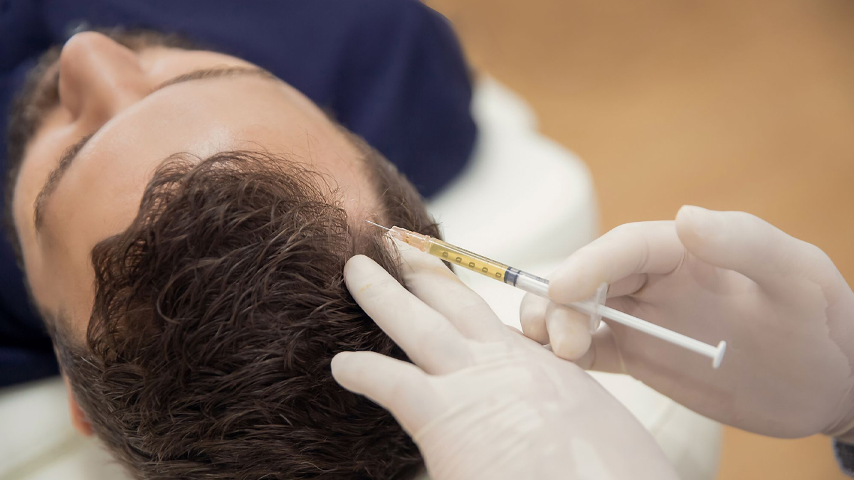 Exosome Hair Therapy