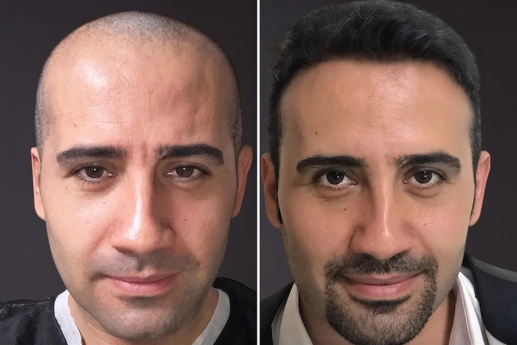 Before treatment