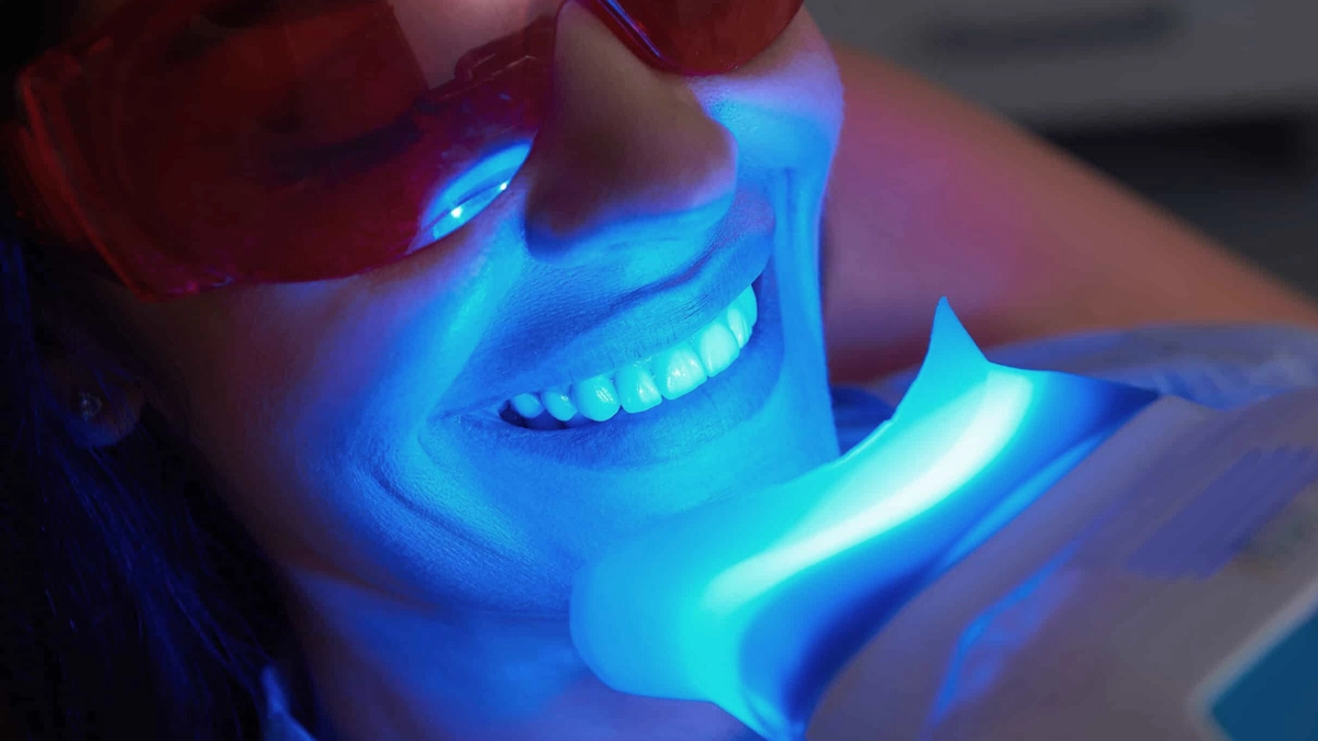 Teeth-Whitening 